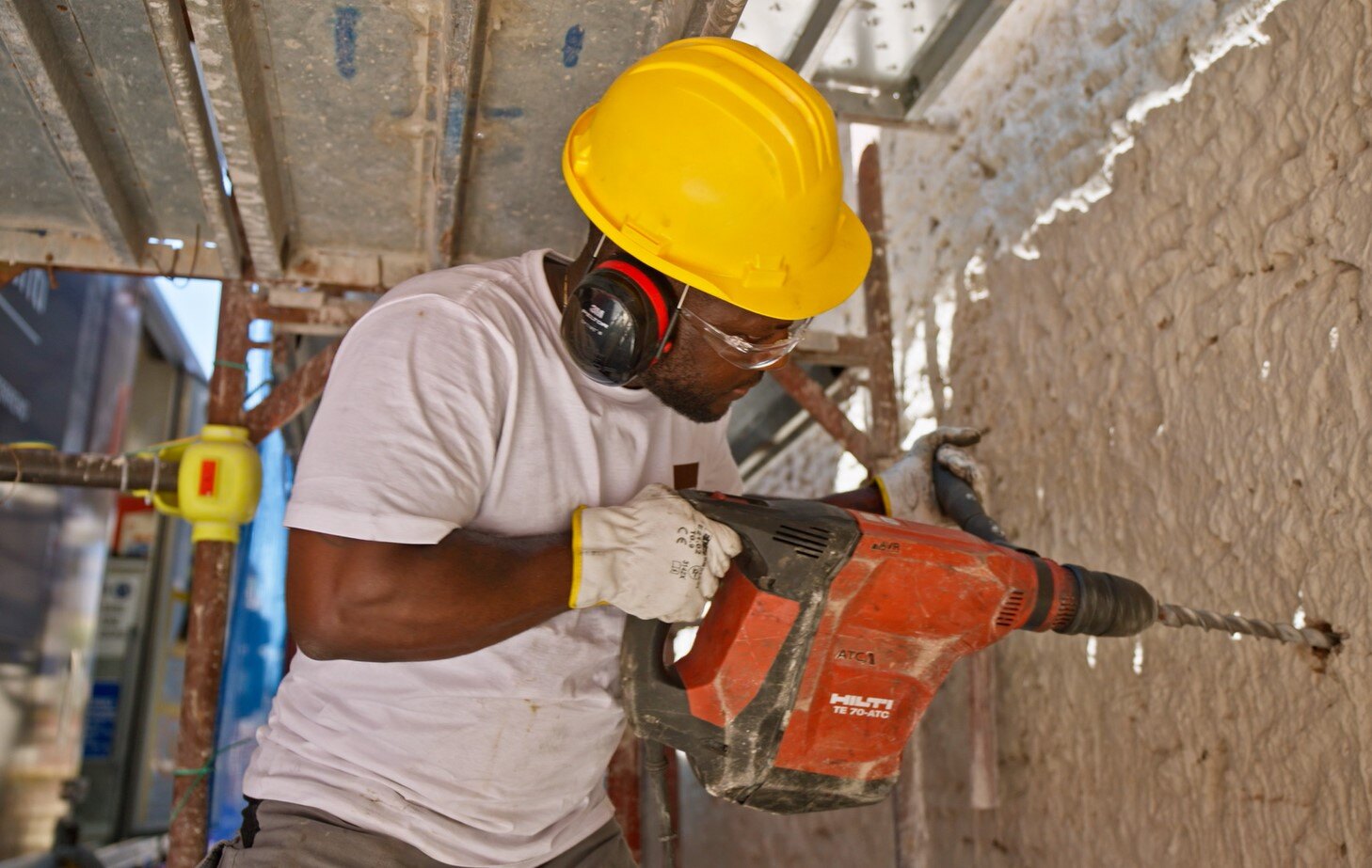 perforazioni microanchors roma